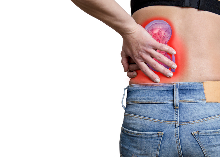 How To Use LavaBags To Treat Kidney Stone Pain